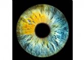 El color de los ojos puede cambiar por enfermedades metablicas, segn una advertencia de la clnica Eyecos