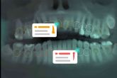 Dentomo lanza la revolucionaria solucin en forma de software para dentistas potenciado por inteligencia artificial