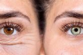 Nuevo color de ojos y blefaroplastia lser; el paquete especial de Clnica Eyecos para un cambio de mirada completo