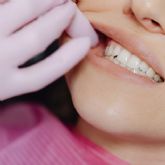 El Centre Dental Francesc Macia presenta su programa sobre la Terapia Miofuncional