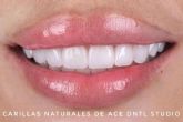 ACE DNTL STUDIO; Redefiniendo la Odontolog�a en Marbella