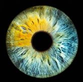 Pecas en los ojos; estas son las caracter�sticas de los nevus oculares