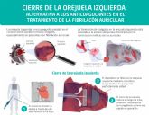 'El cierre de orejuela es una alternativa eficaz para pacientes con fibrilacin auricular que no pueden tomar anticoagulantes', doctor Jos Ramn Rumoroso, jefe de Cardiologa del Hospital Quirnsalud Bizkaia