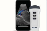 SCPmedical fortalece su catálogo con la línea completa de ecógrafos inalámbricos y portátiles Dawei