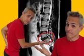 Roberto Galv�n destaca el enfoque m�s eficaz para el tratamiento de la hernia discal L5-S1