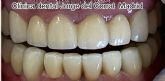 La Cl�nica Dental Jorge del Corral en Hortaleza, Madrid, ofrece implantes dentales con descuento y primera consulta gratuita