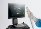 Sonosite LX introduce la ultra-alta frecuencia en POCUS con el primer y nico transductor de 46 MHz