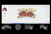 Odontología avanzada en Sabadell; cómo la tecnología redefine la práctica clínica