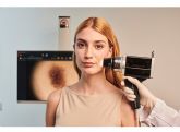 Diagnosticar a tiempo puede cambiarlo todo: IMR alerta sobre el melanoma