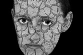 Cinco efectos del confinamiento en la piel que hacen indispensable la visita al dermatólogo, según Cigna
