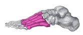 La metatarsalgia es uno de los dolores ms comunes en el pie