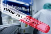 ¿Son las personas con síndrome de Down más vulnerables a la pandemia de COVID-19?
