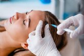 Mesoterapia capilar, un tratamiento para frenar la ca�da del cabello cada vez m�s demandado en la actualidad