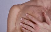 Las cicatrices no son solo est�ticas: pueden provocar dolor, limitar el movimiento y afectar a la calidad de vida