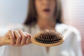 El d�ficit de hierro, origen de la alopecia ferrop�nica o siderop�nica: la segunda causa de ca�da del cabello m�s com�n entre las mujeres