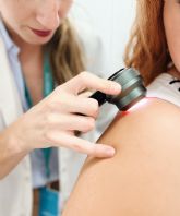 Las hiperpigmentaciones afectan al 90% de las personas mayores de 60 a&ntilde;os