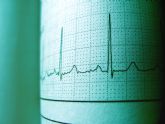 La Universidad de Murcia busca la mejora del tratamiento de pacientes con fibrilacin auricular