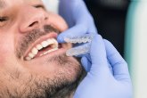 Los expertos dejan 4 consejos para cuidar la ortodoncia invisible