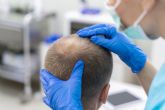 El 50% de la poblaci�n espanola padece alopecia, y de ellos, un 90% es de car�cter androg�nico