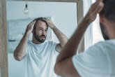 La alopecia androgen�tica, principal causa de ca�da del cabello entre el 80% de la poblaci�n