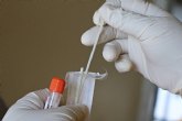 Sanipoint S.L distribuye un test de autodiagnstico que diferencia entre la gripe y el COVID-19