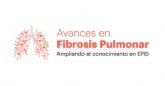 Más de 8 de cada 10 murcianos considera que la fibrosis pulmonar es grave y solicita más divulgación