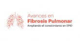 Ms de 8 de cada 10 murcianos considera que la fibrosis pulmonar es grave y solicita ms divulgacin